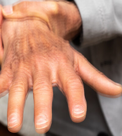 Nahaufnahme der Hand einer älteren Person. Verschwommenes Bild soll zeigen, dass die Hand stark zittert.