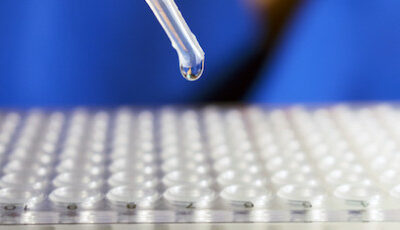 Pipette tropft Stammzellen Forschungsflüssigkeit in PCR Platte von Ärzten