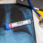Blutprobe-Röhrchen mit der Aufschrift "RSV"