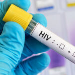 HIV-positive Blutprobe